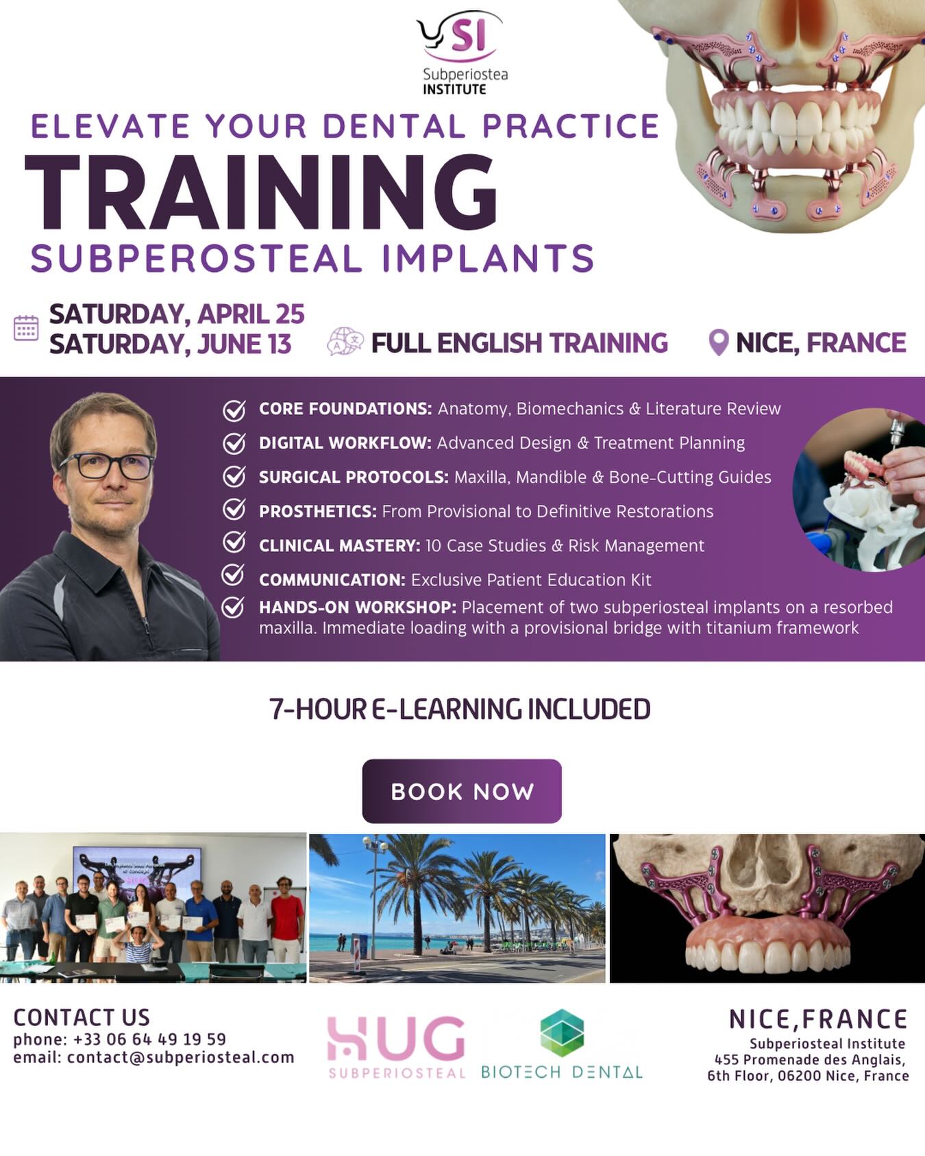 Elevate Your Clinical Expertise with Subperiostea Institute 🦷
Are you ready to master advanced implantology? Join us in the beautiful city of Nice, France, for an intensive training session on Subperiosteal Implants.
📅 Dates: Saturday, April 25 or Saturday, June 13
📍 Location: Nice, France 🌴☀️
🎓 7 hours of E-Learning!
🛠️ Hands-on: Practice placement on a resorbed maxilla with immediate loading protocols.
Don’t miss this opportunity to refine your surgical skills and offer new solutions to your patients !
📩 Ready to upgrade your practice? Contact us today at contact@subperiosteal.com or call +33 6 64 49 19 59 to secure your spot!
#SubperiostealImplants #Implantology #OralSurgery #DentalTraining #DentalEducation DigitalDentistry