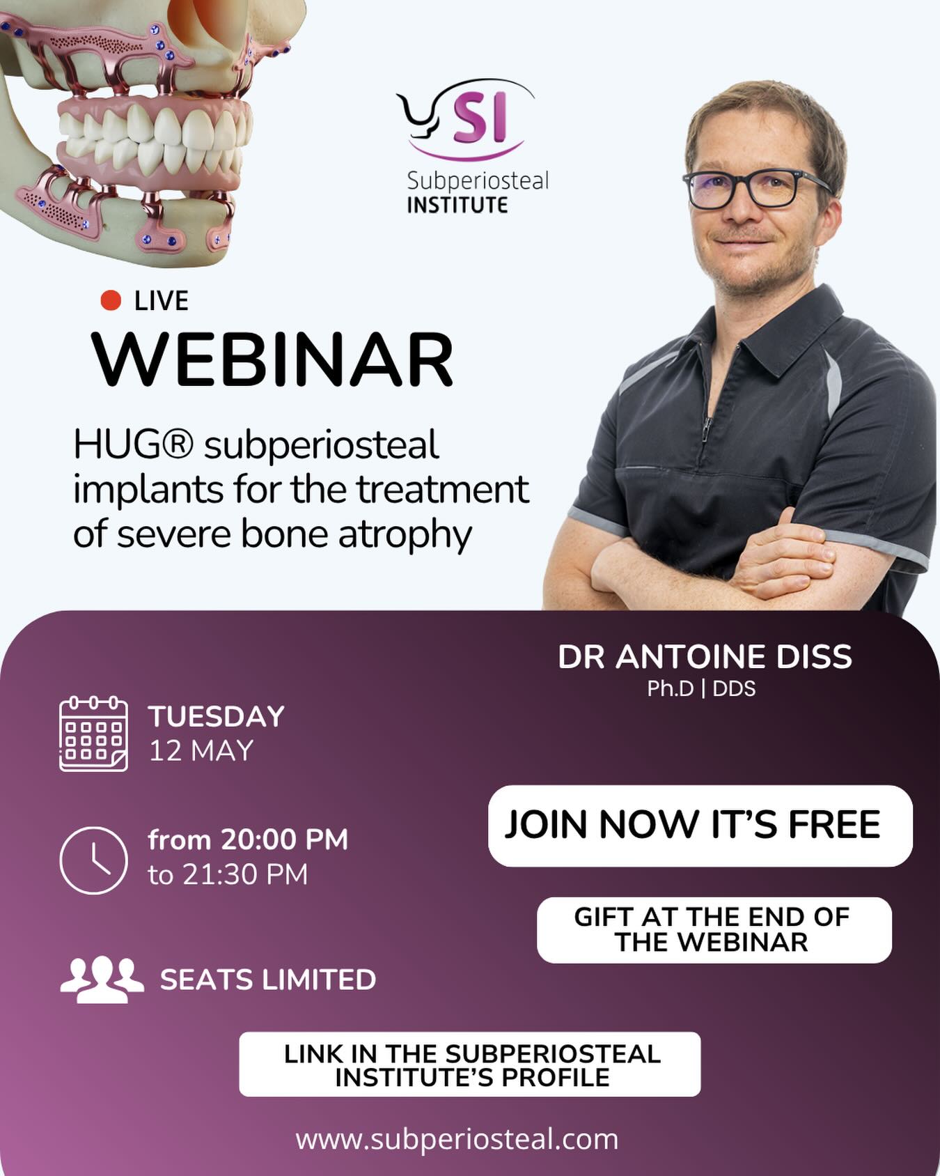 🚨 LIVE WEBINAR: Seats are filling fast!
Ready to discover the future of implantology?
Join Dr. Antoine Diss for an exclusive masterclass on digital subperiosteal implants and the treatment of extreme bone atrophy!
📅 Tuesday, May 12 |
🕗 8:00 PM - 9:30 PM - PARIS TIME (CEST)
🎟 FREE ENTRY (Limited availability)
👉 LINK IN BIO
🎁 WE HAVE A EXCLUSIVE GIFT for those who stay until the end of the live session. Trust us, you don’t want to miss this one.
Will you be there on May 12? Drop a « READY » in the comments! 👇
#Implantology #HUGConcept #webinar #dentist #implant