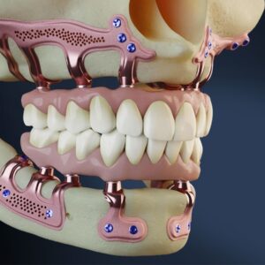ENTRENAMIENTO EN IMPLANTES SUBPERIÓSTICOS – 13 de junio de 2026 – NIZA
